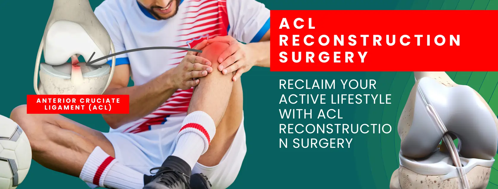 ACL reconstruction surgery in Delhi by orthopedic surgeon