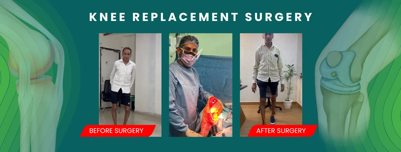 Knee pain treatment in Delhi by experienced orthopedic specialist
