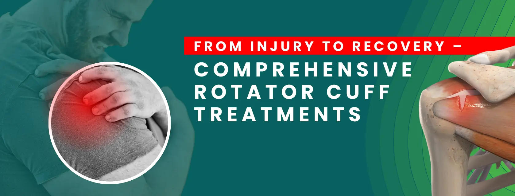 Comprehensive rotator cuff treatment by orthopedic doctor in Delhi